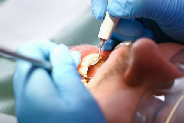 Best Emergency Dental Services for Seniors in King George, VA