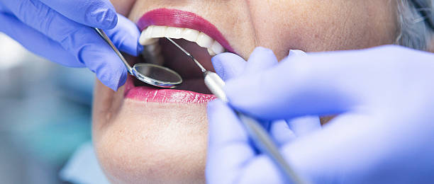 Best Emergency Dentist for Knocked-Out Tooth in King George, VA